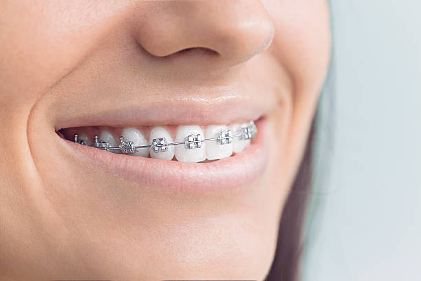 Best Root Canal Treatment  in Rock Hill, MO